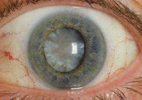 28464844371_08946eba30_b